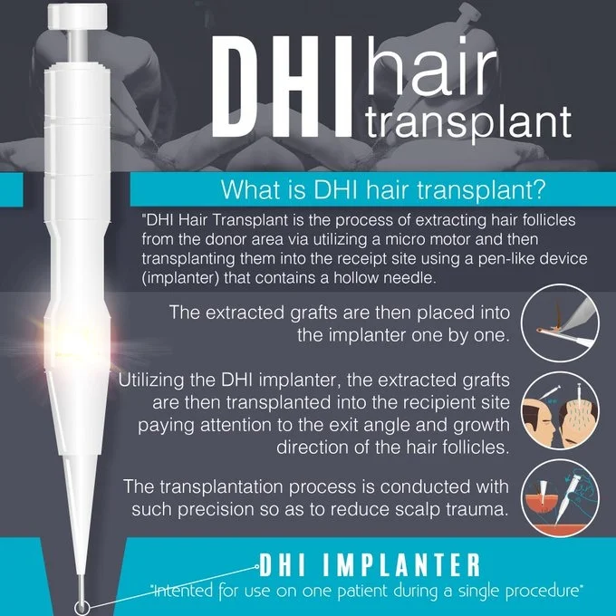 What is DHI Hair Transplant?