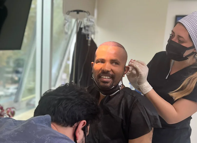 final touches after afro hair transplant in turkey