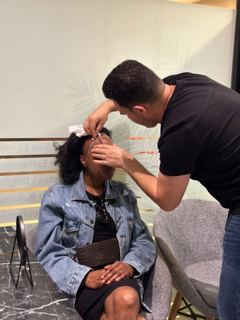 female afro hair transplant in turkey