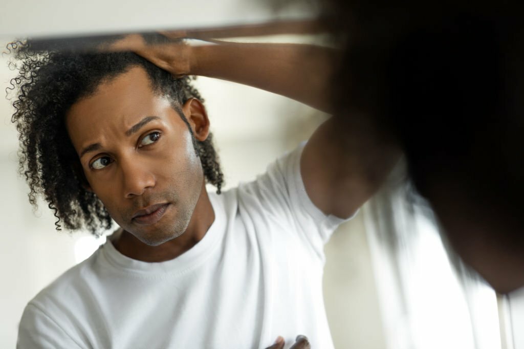 hair transplant side effects